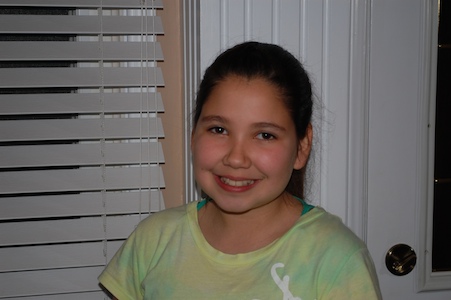 Angela pre-braces
