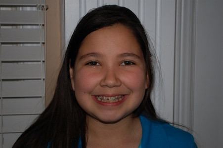 Angela with braces